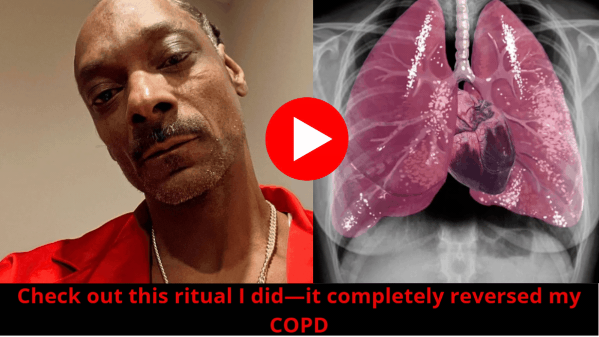 Watch Video